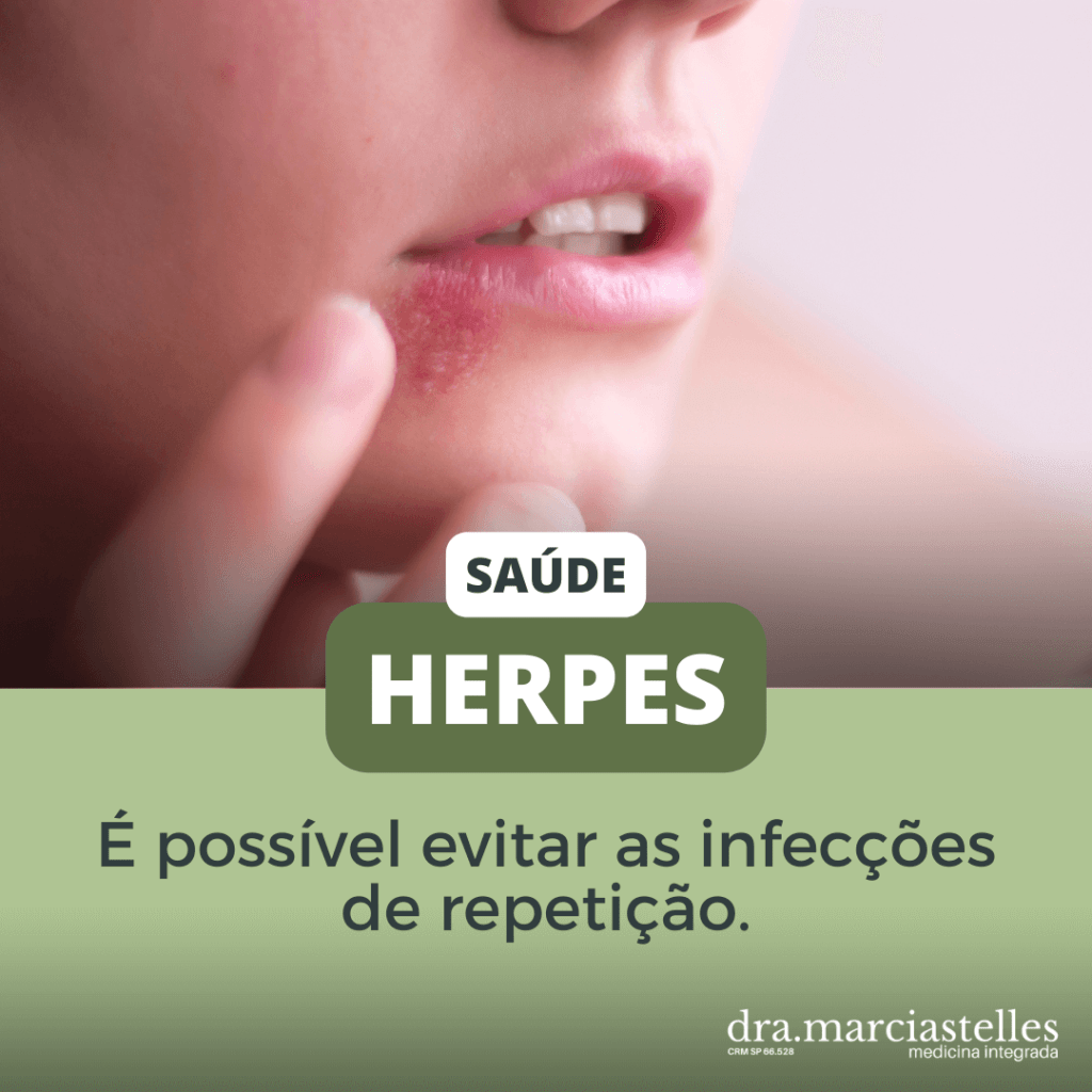 Tratamento para Herpes - Medicina Integrada SP